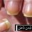 علت زرد شدن ناخن